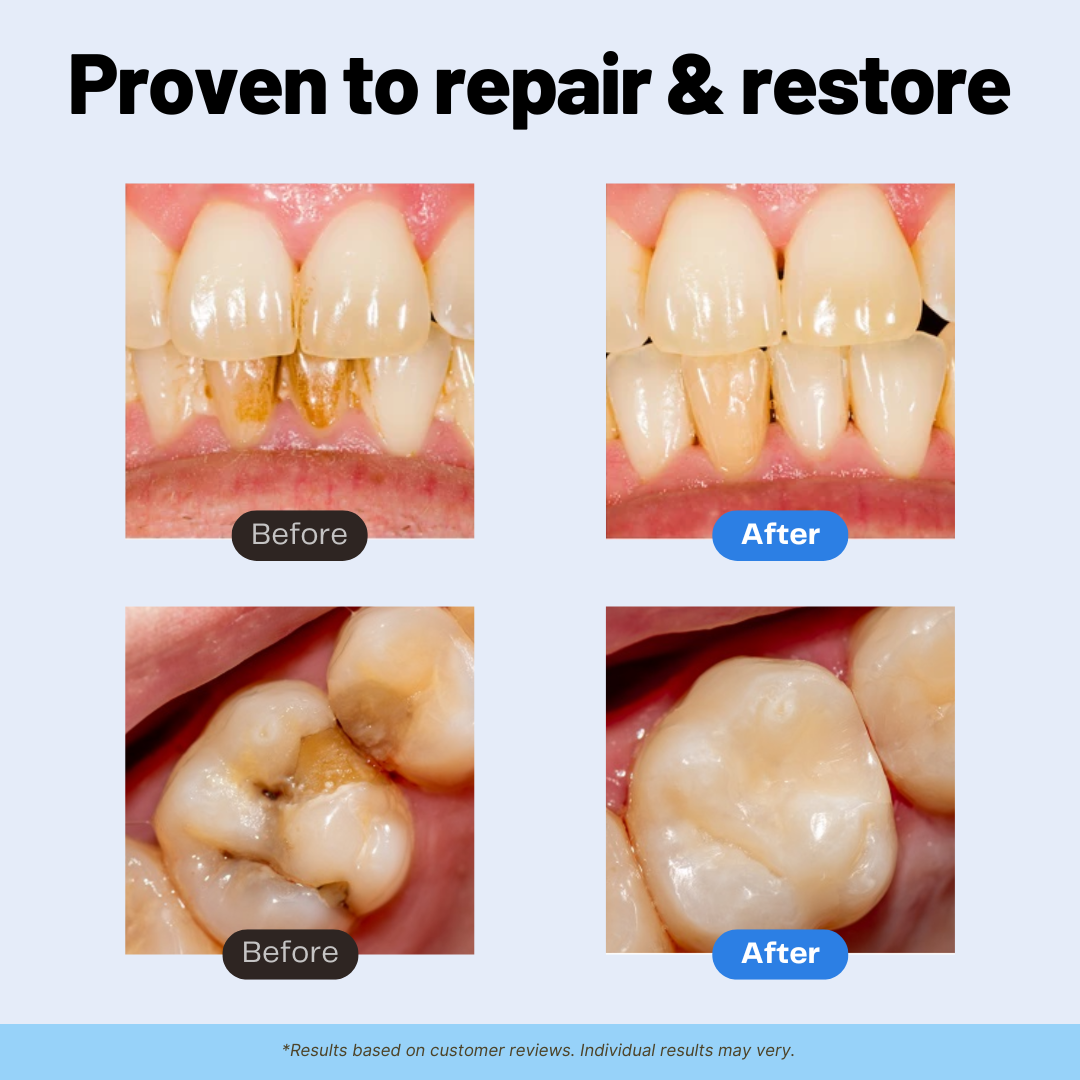 Remineralizing Repair+ Toothpaste