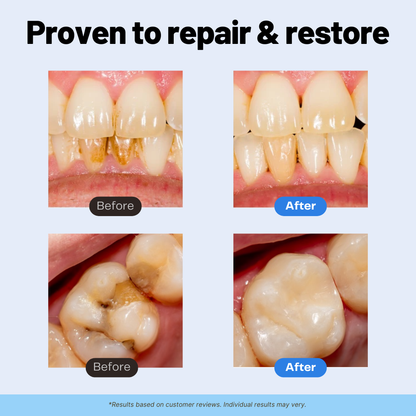 Remineralizing Repair+ Toothpaste